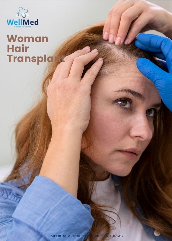 FUE Technique Hair Transplant for Women  Medco Healthco  Stay Safe and  Healthy